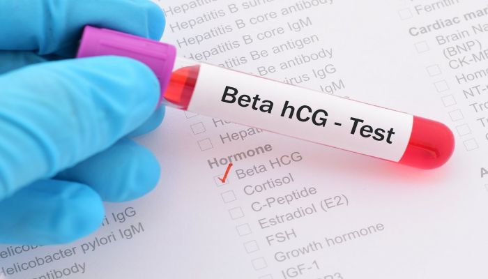 Hình 3: Xét nghiệm Beta HCG để biết bạn có thai hay không