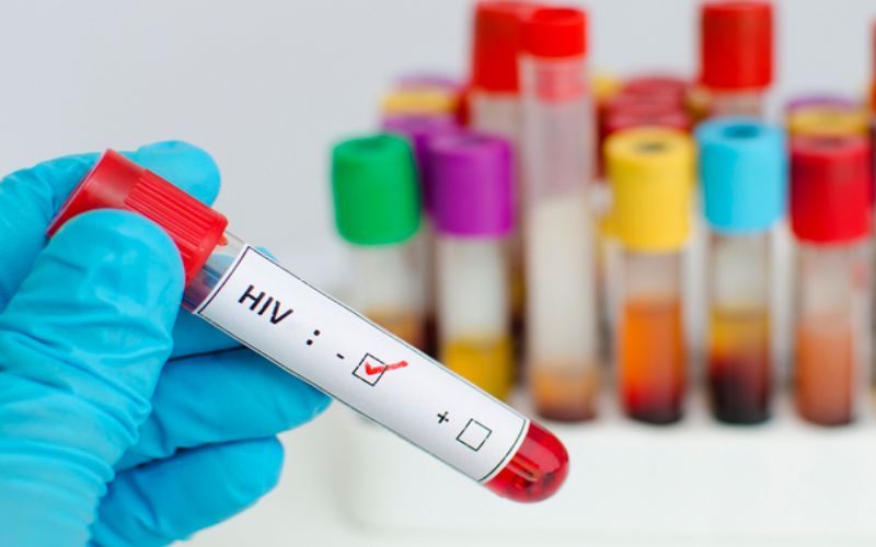 Hinh 2 Ket qua xet nghiem HIV am tinh