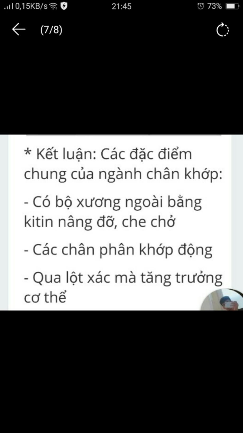 cau-1-neu-dac-diem-cua-tom-song-nhen-chau-chau-tu-do-rut-ra-dac-diem-chung-cua-nganh-chan-khop-c