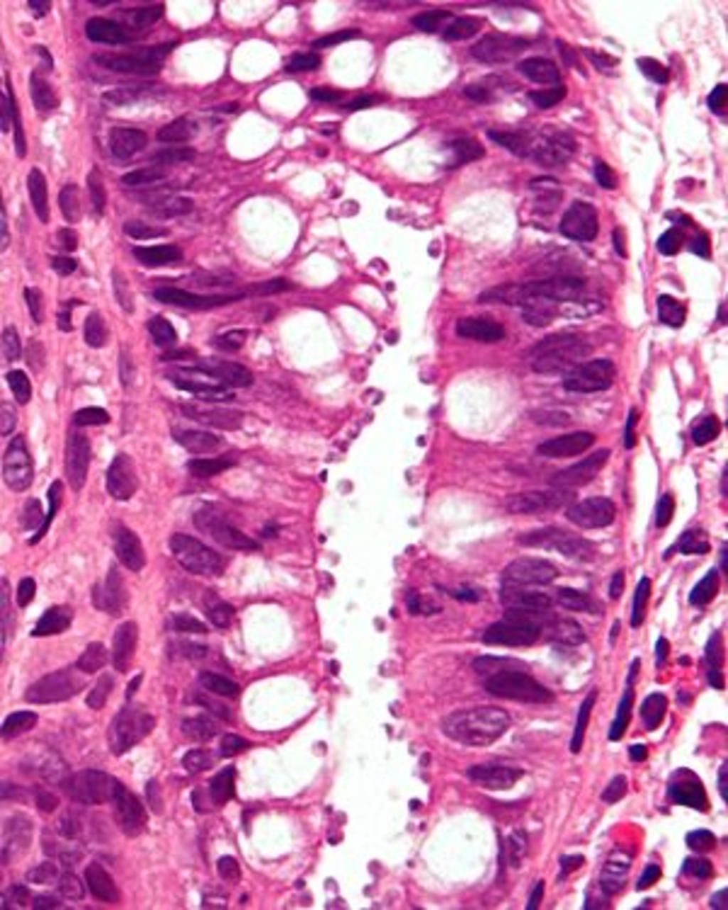 vi-sao-con-nguoi-bi-benh-do-cryptosporidium